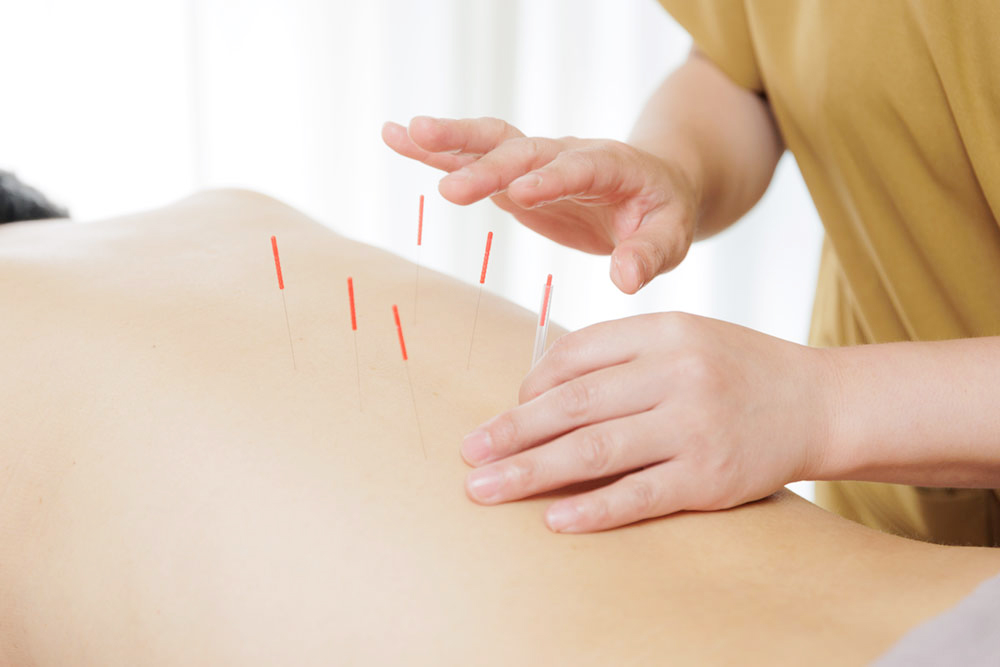 鍼灸治療院La
Pausa|鍼