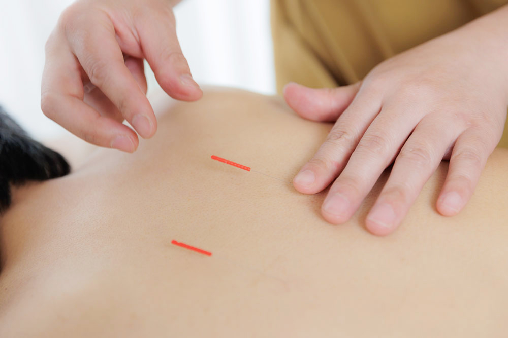 鍼灸治療院La
Pausa|鍼