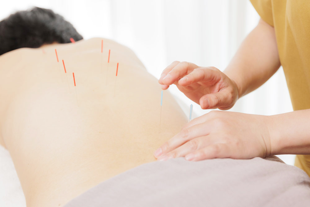 鍼灸治療院La
Pausa|鍼・電気