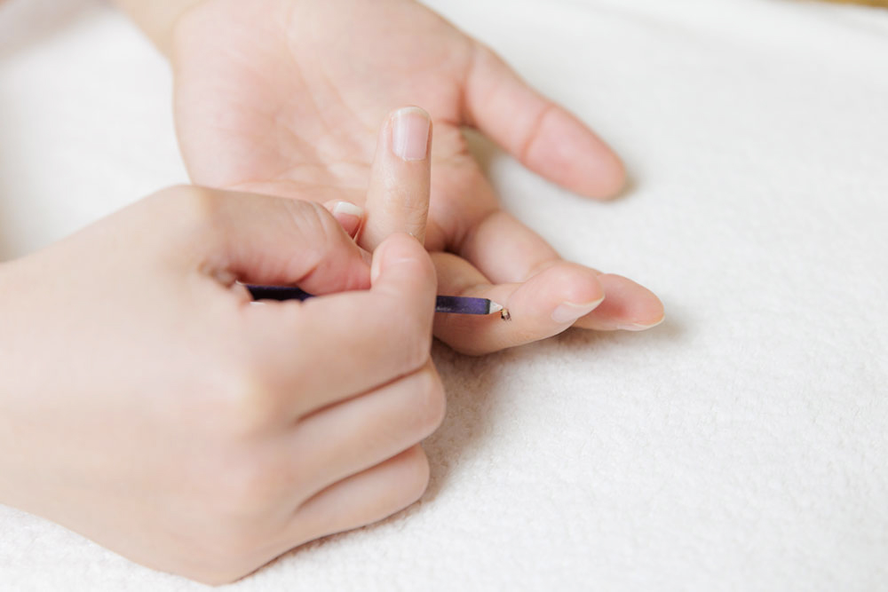 鍼灸治療院La
Pausa|灸